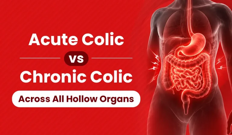 Difference Between Acute Colic and Chronic Colic Key takeaways explaining that pain intensity does not distinguish acute from chronic colic; instead, the key factors are whether the pain resolves after a temporary cause or persists or recurs due to an ongoing underlying problem.